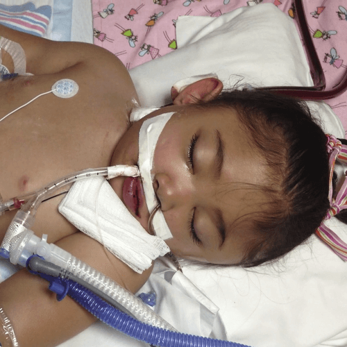 Angelica Hale - 4 Years Old - Life Support